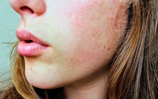 skin
