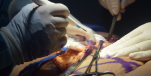Surgery 