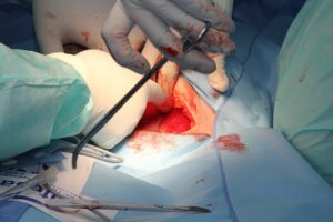 surgery